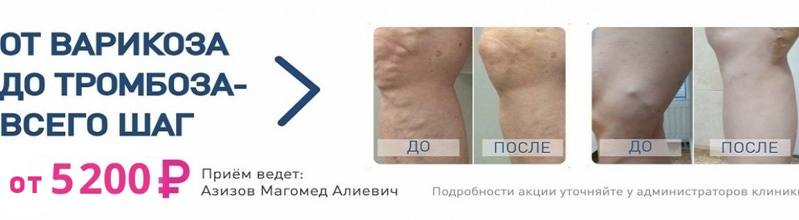 Флебология