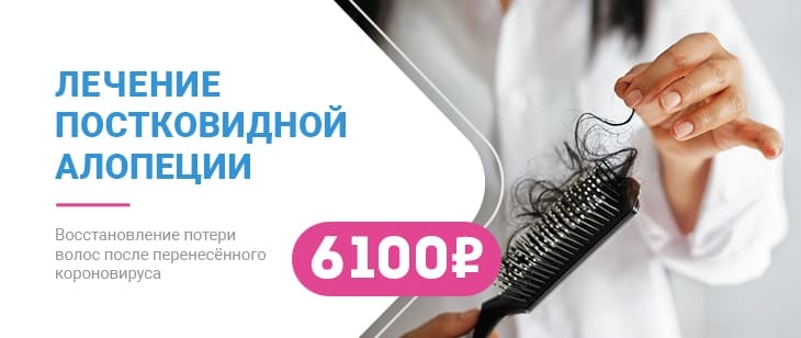 Лечение постковидной алопеции