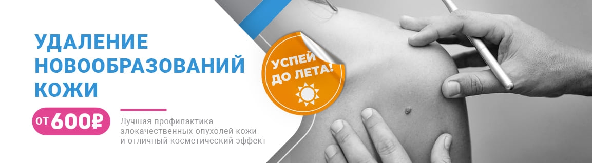Удаление новообразований кожи