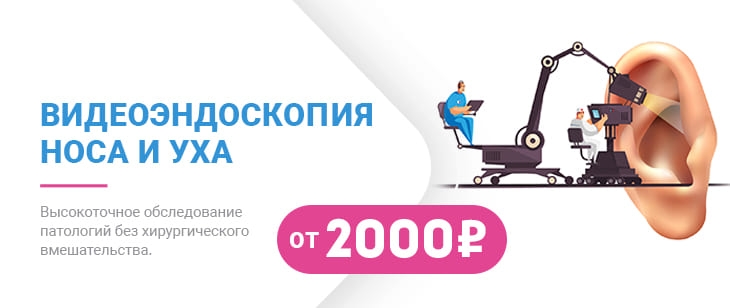 Видеоэндоскопия носа и ушей!