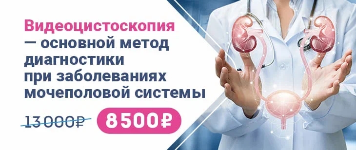Видеоцистоскопия