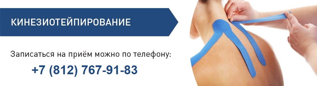 Кинезиотейпирование 