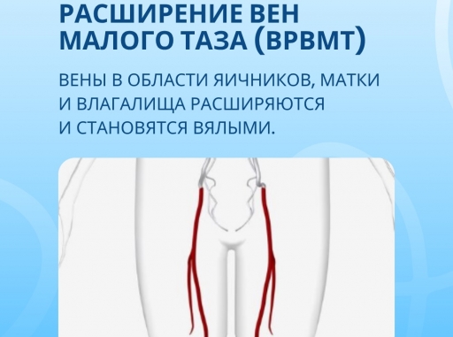 Что общего у гинеколога и флеболога?