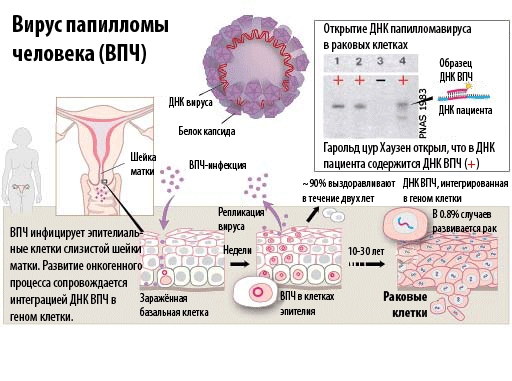 Вирус папилломы человека